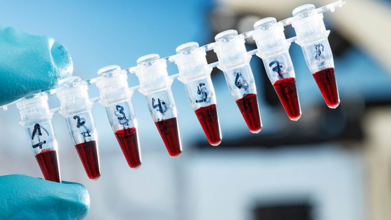 Coronavirus : le test sérologique pas encore d’actualité dans la région
